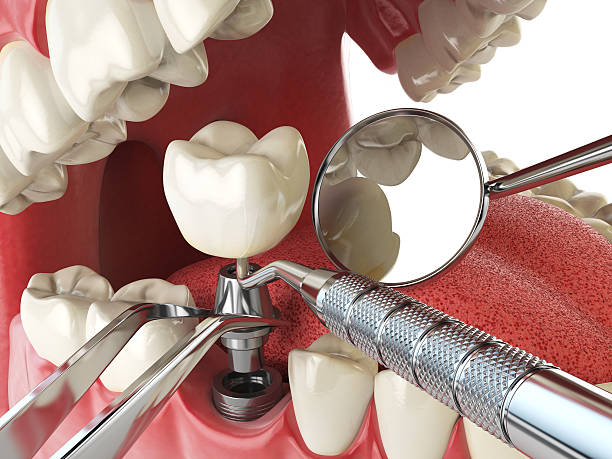 Reliable SD Emergency Dentist Solutions