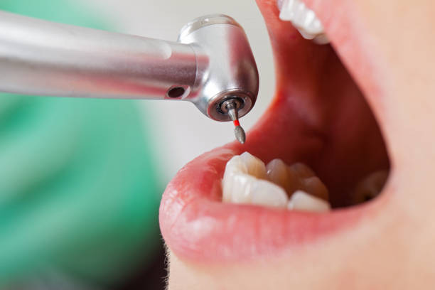 Best Emergency Treatment for Toothache in Martin, SD